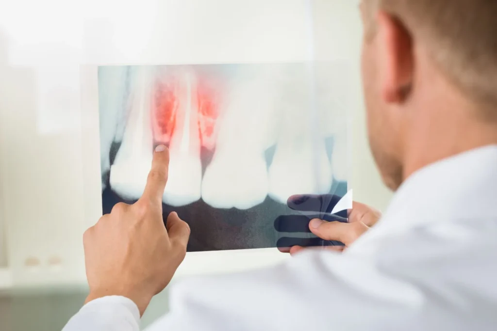 how to get rid of gum disease